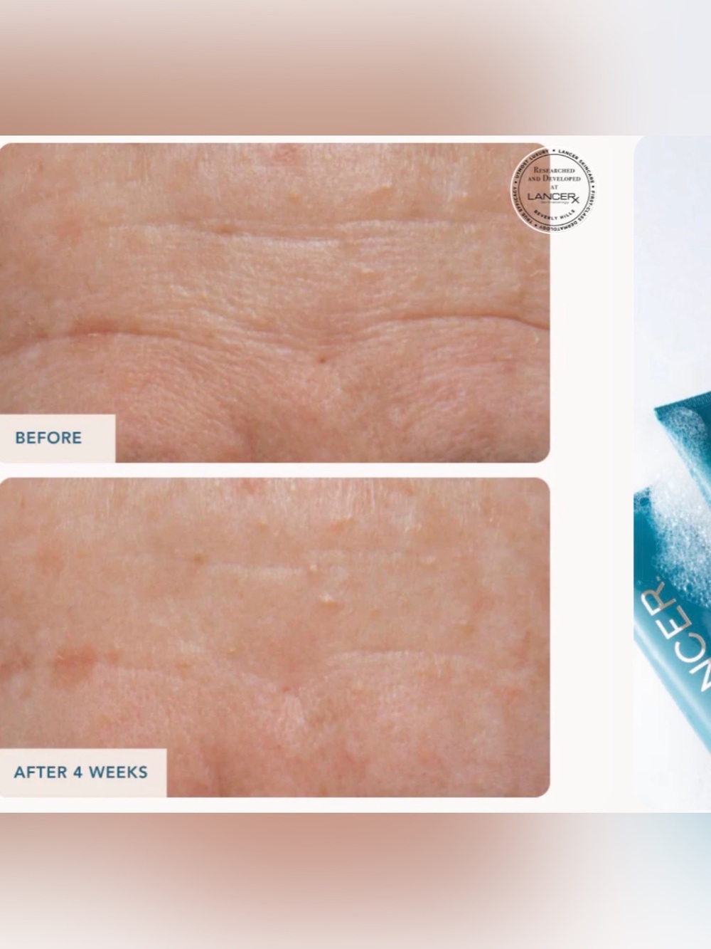 Lancer The Method: Cleanse Normal-Combination Skin - Picture 4 of 6